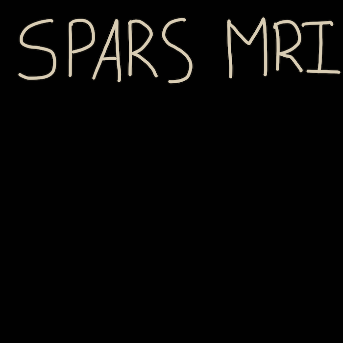 SPARS MRI