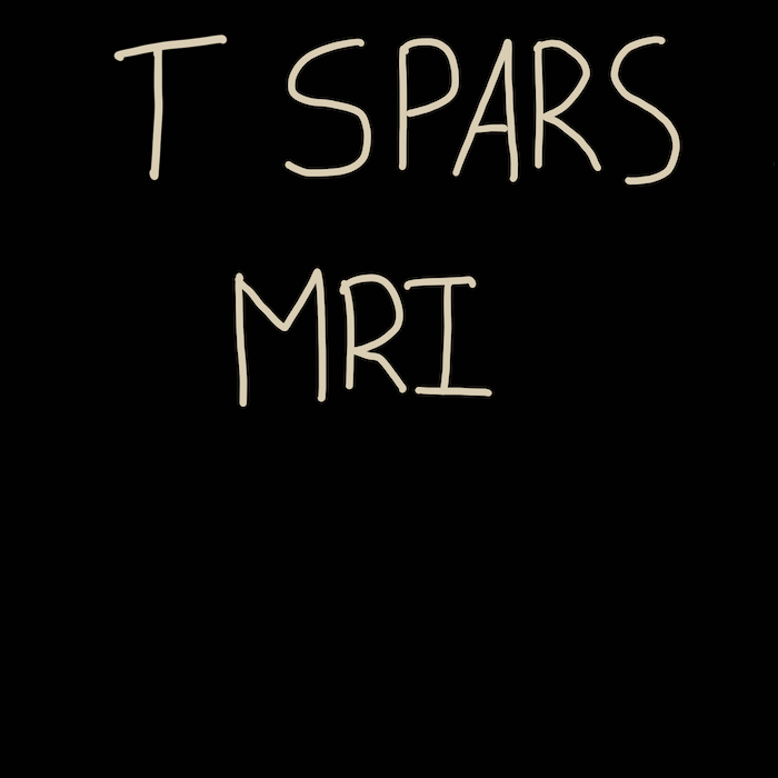 T SPARS MRI